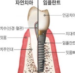 내부시설-광교치과 엘포트 해피치과의원