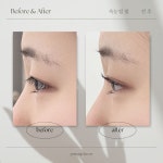 케어-예썹브로우