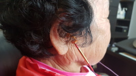 스타키보청기 종로센터