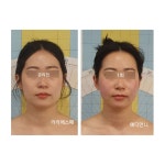 라라에스떼/ 얼굴축소연구소