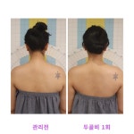 라라에스떼/ 얼굴축소연구소