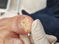 레푸스 방이역점