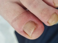 레푸스 방이역점