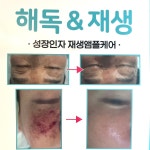 뷰티호텔