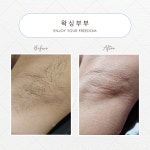 왁싱부부 부천본점