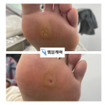 엠블케어