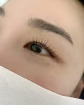 아이포유