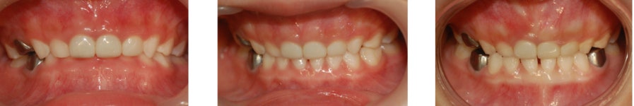 오즈어린이치과의원