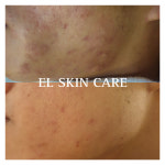 엘스킨케어