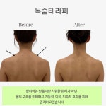 매끄롬 대구죽전점