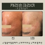 탱탱스킨앤바디(Tang Tang Skin&Body) | 탱탱스킨바디 포항점