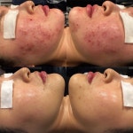 웰라인 스킨앤바디