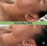 한끗에스테틱 부산서면점