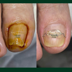 디에고푸스 구의점 초롱쌀롱