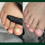 디에고푸스 구의점 초롱쌀롱