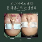비나인에스테틱 부천점