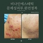 비나인에스테틱 부천점