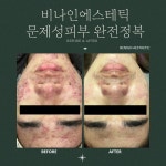 비나인에스테틱 부천점