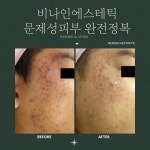 비나인에스테틱 부천점