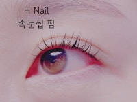 H네일