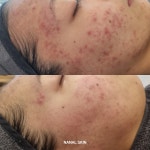 나날스킨 강남본점