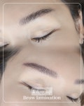 정관 브로우업