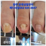 뷰티업라이프 페디네일 광주본점
