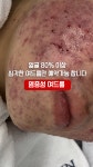 더고은피부전문센터 다산본점