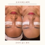 오티아에스테틱