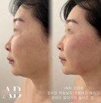안뷰티왁싱 파주운정본점