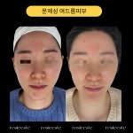 로지에스떼 서초 잠원본점