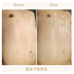 참슈가링왁싱