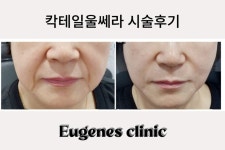 유진스의원