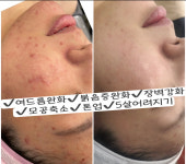 유앤희에스테틱 광주첨단점