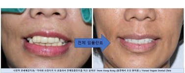 연세예감치과의원