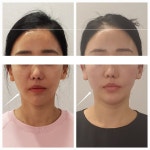 일산화룡체형교정원&피부 | 비대칭 체형관리 약손금손