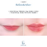 리프업의원 잠실