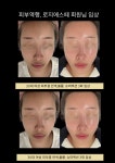 로지에스떼 서초 잠원본점