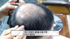 그랜드가발에스엠피 | 그랜드가발 본점
