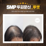 루엣