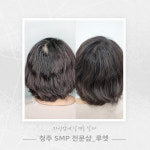 루엣