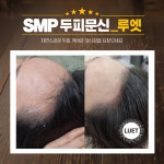 루엣