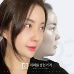 리미트성형외과의원