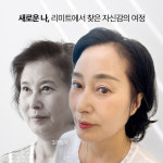 리미트성형외과의원