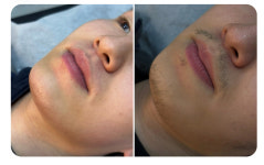 아나덴 슈가링왁싱 삼송역점