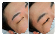 아나덴 슈가링왁싱 삼송역점