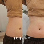 성형안해도 청초 의정부민락점