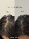 다린스칼프