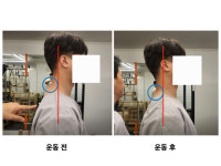 리커버리유 재활운동센터