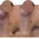쉼,에스테틱